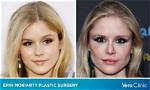 Unveiling the Journey of Erin Moriarty: a Transformative Odyssey