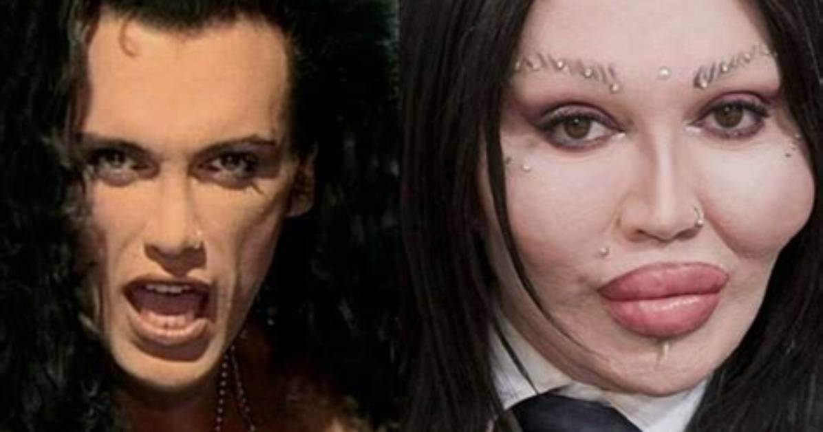 Unveiling the Mysteries Surrounding Pete Burns' Death Cause