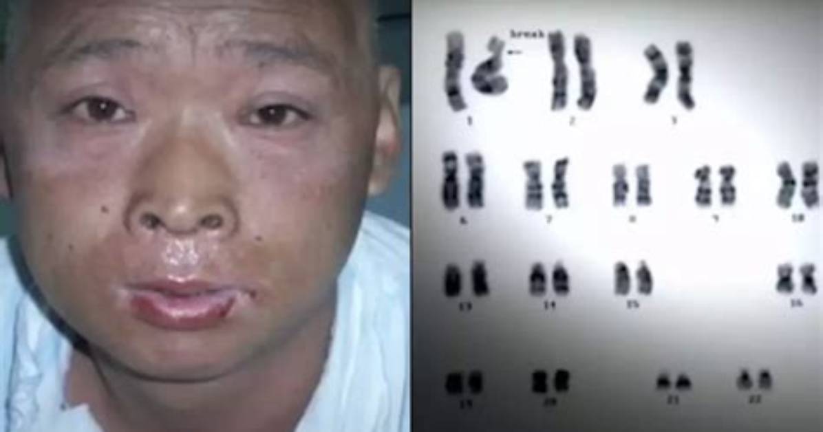 Unveiling the Secrets of Hisachi Ouchi Skin