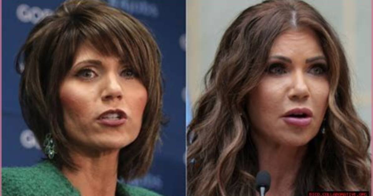 Unveiling the Secrets of "Noem Before and After": a Transformative Skin Journey