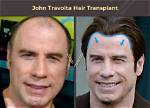 Unveiling the Secrets to John Travolta's Staggering Net Worth