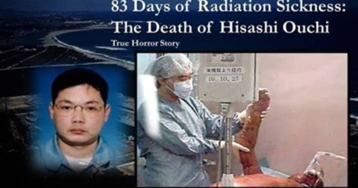 Unveiling the Tragic Journey: Hisashi Ouchi's Medical Report