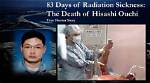 Unveiling the Tragic Journey: Hisashi Ouchi's Medical Report