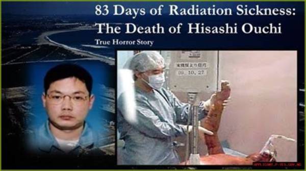 Unveiling the Tragic Tale of Hisashi Ouchi: Real Photos from 1999