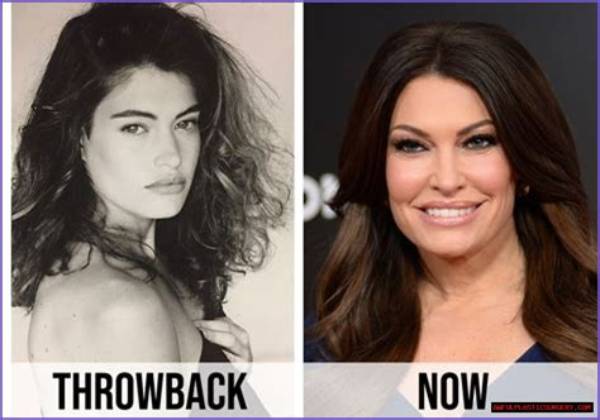 Unveiling the Transformation: Kimberly Guilfoyle Before and After Photos