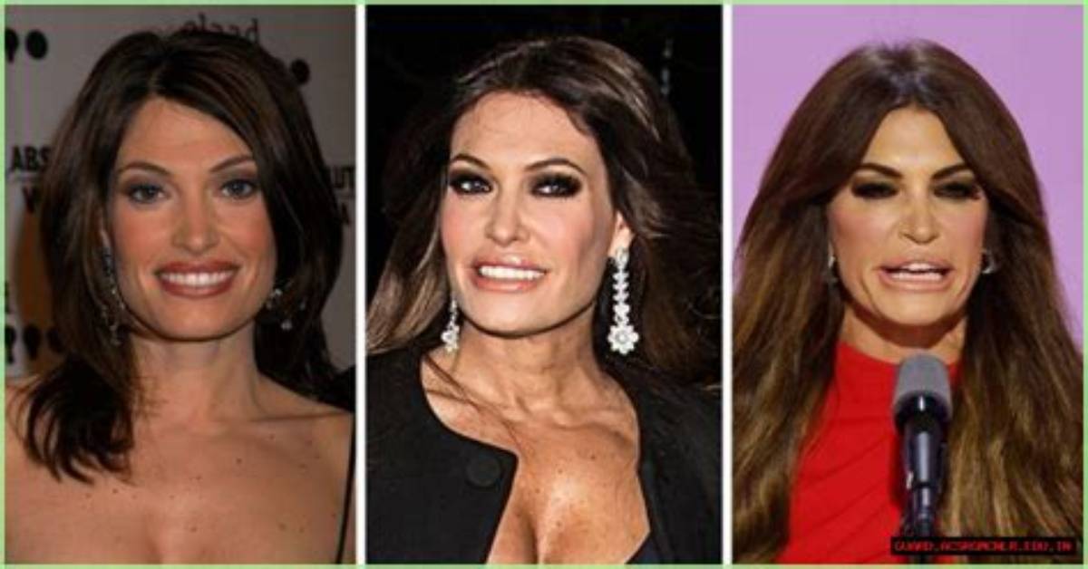 Unveiling the Transformation: Kimberly Guilfoyle's Face Change
