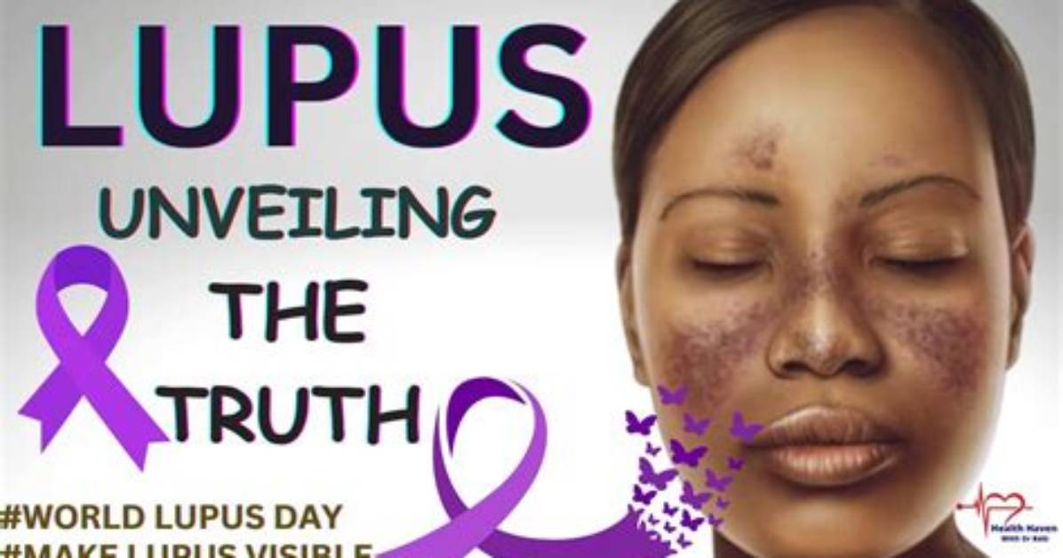 Unveiling the Truth About Lupus