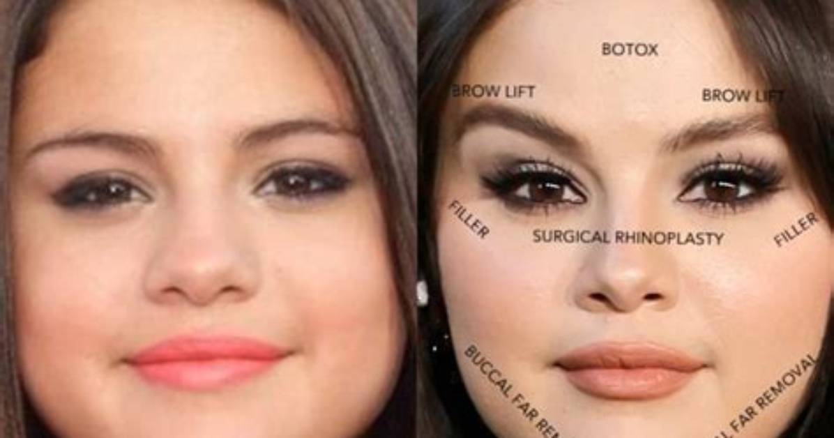Unveiling the Truth Behind "Selena Gomez Is Pregnant"
