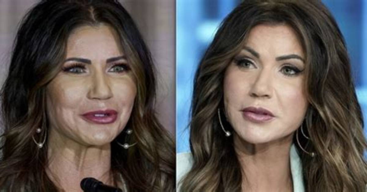 Unveiling the Truth: Christy Noem's Plastic Surgery Journey