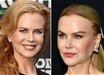 Unveiling the Truth: Did Nicole Kidman Have Plastic Surgery?