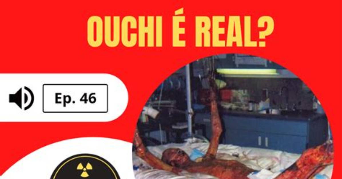 Unveiling the Truth: Hisashi Ouchi Real Photos on Google