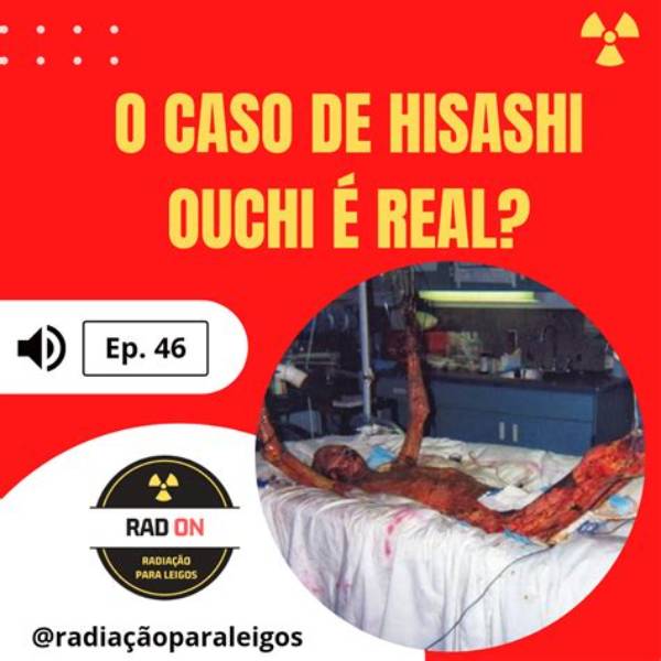 Unveiling the Truth: Hisashi Ouchi Real Photos on Google