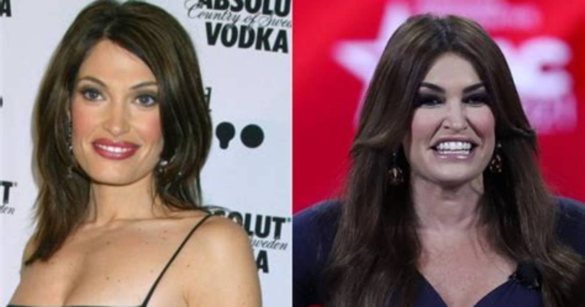 Unveiling the Truth: Kim Guilfoyle's Plastic Surgery Journey