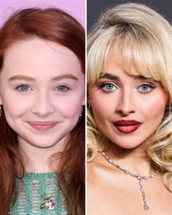 Unveiling the Truth: Sabrina Carpenter Before Surgery