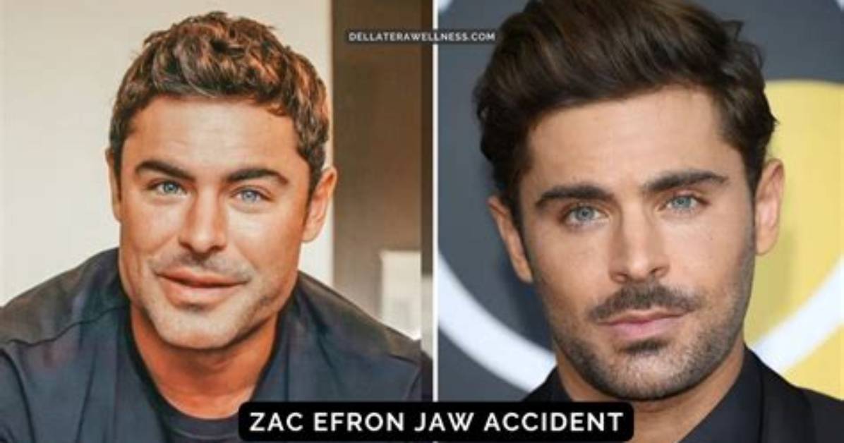 Unveiling Zac Efron's Accident: Discoveries and Insights