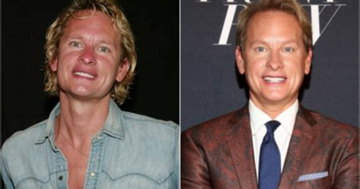 What Did Carson Kressley Look Like Before and After Plastic Surgery?