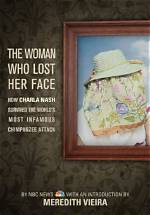 What Happened to Charla Nash? Is Charla Nash Blind?