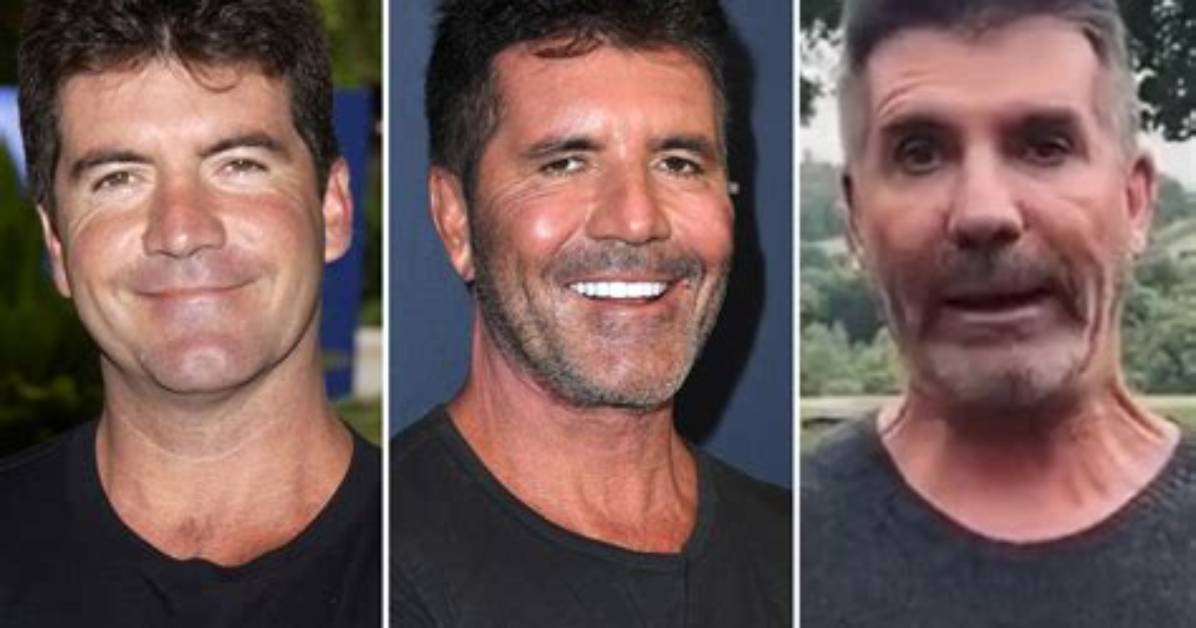 What Happened to Simon Cowell Face and Eye? Has He Had a Stroke or an Accident?