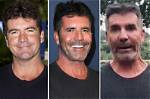What Happened to Simon Cowell Face and Eye? Has He Had a Stroke or an Accident?