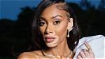 What Really Happened to Winnie Harlow? the Surprising Truth