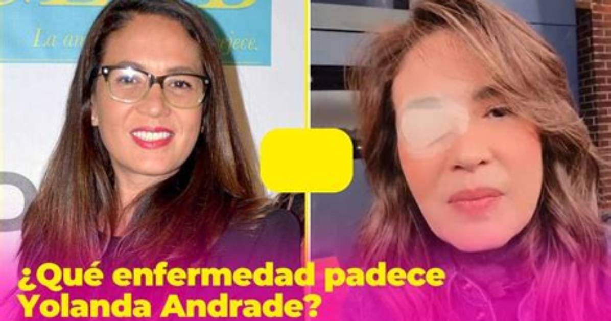 Yolanda Andrade: a Journey Through Fame and Controversy