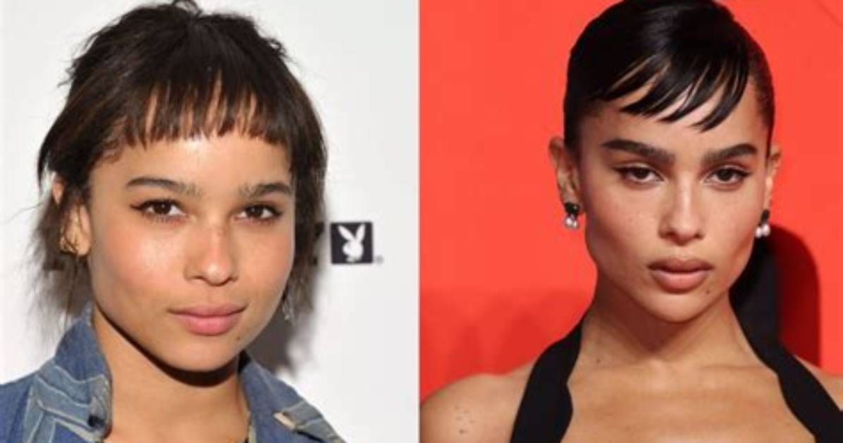 Zoe Kravitz Plastic Surgery: Before and After
